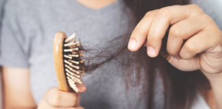 Hair Loss in Women: 15 Tips to Prevent and Manage Female Balding