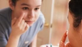 Quick Tips: Can You Use Benzoyl Peroxide on Your Face?