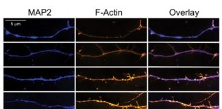Psychedelics Are Good for Neuroplasticity in Rats. What About Humans?