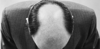 Why Aren’t There More Patterns in Male Pattern Baldness?